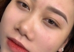 Mộc Anh Beauty - chăm sóc & điều trị da khoa học
