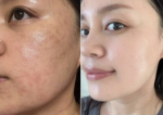 Mộc Anh Beauty - chăm sóc & điều trị da khoa học