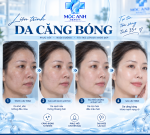 Mộc Anh Beauty - chăm sóc & điều trị da khoa học