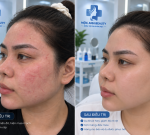 Mộc Anh Beauty - chăm sóc & điều trị da khoa học